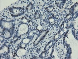 UNG Monoclonal Antibody (OTI2F8), TrueMAB , OriGene 30 &mu;L; Unconjugated:Antibodies,