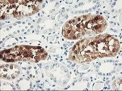 UNG Monoclonal Antibody (OTI2C12), TrueMAB , OriGene 100 &mu;L; Unconjugated:Antibodies,