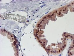 UNG Monoclonal Antibody (OTI1F8), TrueMAB , OriGene 100 &mu;L; Unconjugated:Antibodies,