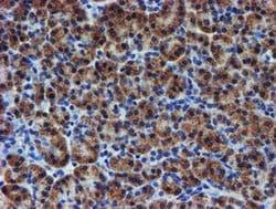 UNG Monoclonal Antibody (OTI1F8), TrueMAB , OriGene 100 &mu;L; Unconjugated:Antibodies,