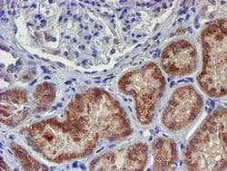 UNG Monoclonal Antibody (OTI1F8), TrueMAB , OriGene 100 &mu;L; Unconjugated:Antibodies,