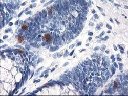 UNG Monoclonal Antibody (OTI2B5), TrueMAB , OriGene 100 &mu;L; Unconjugated:Antibodies,