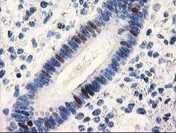UNG Mouse anti-Human, Clone: OTI1G2, lyophilized, TrueMAB 100 &mu;g; Unconjugated:Antibodies,