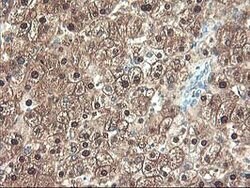 UNG Mouse anti-Human, Clone: OTI1G2, lyophilized, TrueMAB 100 &mu;g; Unconjugated:Antibodies,
