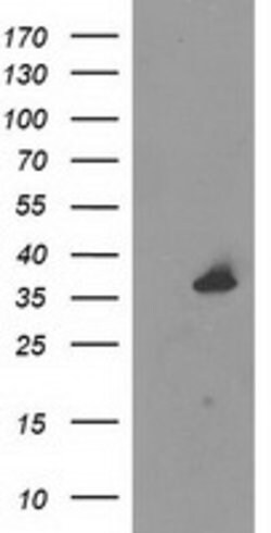 UNG Mouse anti-Human, Clone: OTI1A11, lyophilized, TrueMAB 100 &mu;g; Unconjugated:Antibodies,