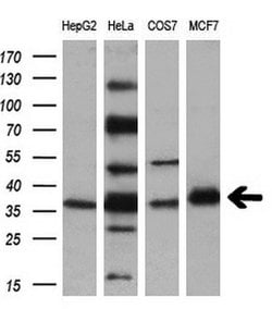 UNG Mouse anti-Human, Clone: OTI1A11, lyophilized, TrueMAB 100 &mu;g; Unconjugated:Antibodies,