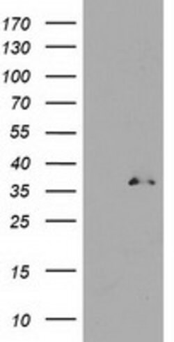 UNG Mouse anti-Human, Clone: OTI2F8, lyophilized, TrueMAB 100 &mu;g; Unconjugated:Antibodies,