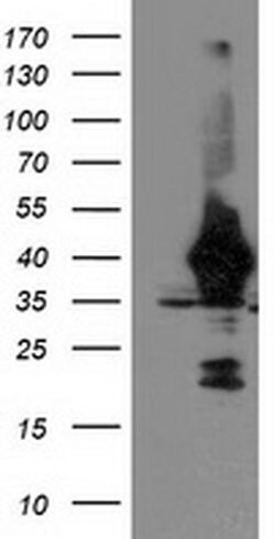 UNG Monoclonal Antibody (OTI2C12), TrueMAB , OriGene 100 &mu;L; Unconjugated:Antibodies,