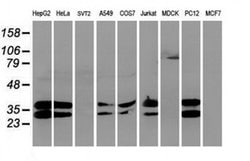UNG Monoclonal Antibody (OTI2C12), TrueMAB , OriGene 100 &mu;L; Unconjugated:Antibodies,