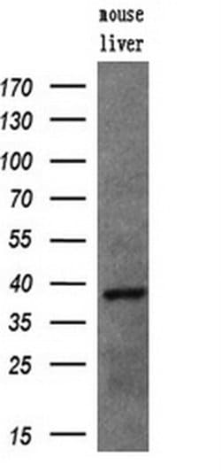 UNG Monoclonal Antibody (OTI2C12), TrueMAB , OriGene 100 &mu;L; Unconjugated:Antibodies,