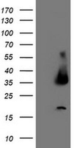 UNG Monoclonal Antibody (OTI1F8), TrueMAB , OriGene 100 &mu;L; Unconjugated:Antibodies,