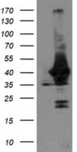 UNG Mouse anti-Human, Clone: OTI1G2, lyophilized, TrueMAB 100 &mu;g; Unconjugated:Antibodies,