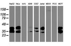 UNG Mouse anti-Human, Clone: OTI1G2, lyophilized, TrueMAB 100 &mu;g; Unconjugated:Antibodies,