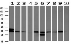 UNG Mouse anti-Human, Clone: OTI1G2, lyophilized, TrueMAB 100 &mu;g; Unconjugated:Antibodies,