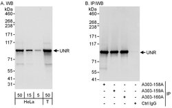 UNR Rabbit anti-Human, Polyclonal, Bethyl Laboratories 100 &mu;L; Unconjugated:Antibodies,