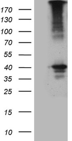 UPP2 Monoclonal Antibody (OTI11F11), TrueMAB , OriGene 100 &mu;L; Unconjugated:Antibodies,