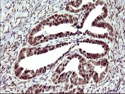 UPRT Mouse anti-Human, Clone: OTI1C9, lyophilized, TrueMAB 100 &mu;g; Unconjugated:Antibodies,