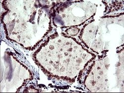 UPRT Mouse anti-Human, Clone: OTI1C9, lyophilized, TrueMAB 100 &mu;g; Unconjugated:Antibodies,