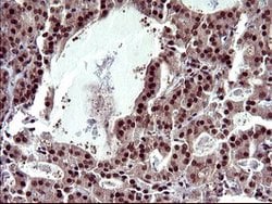 UPRT Mouse anti-Human, Clone: OTI1C9, lyophilized, TrueMAB 100 &mu;g; Unconjugated:Antibodies,
