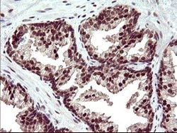 UPRT Mouse anti-Human, Clone: OTI1C9, lyophilized, TrueMAB 100 &mu;g; Unconjugated:Antibodies,