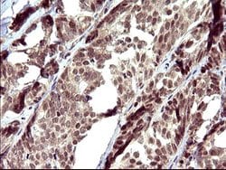UPRT Mouse anti-Human, Clone: OTI1C9, lyophilized, TrueMAB 100 &mu;g; Unconjugated:Antibodies,