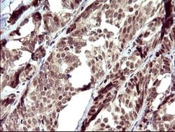 UPRT Monoclonal Antibody (OTI1C9), TrueMAB , OriGene 30 &mu;L; Unconjugated:Antibodies,