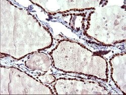 UPRT Monoclonal Antibody (OTI1A3), TrueMAB , OriGene 100 &mu;L; Unconjugated:Antibodies,