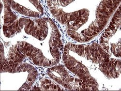 UPRT Monoclonal Antibody (OTI1A3), TrueMAB , OriGene 100 &mu;L; Unconjugated:Antibodies,