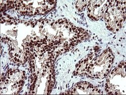 UPRT Monoclonal Antibody (OTI1A3), TrueMAB , OriGene 100 &mu;L; Unconjugated:Antibodies,