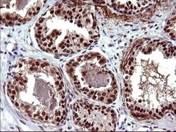 UPRT Monoclonal Antibody (OTI1A3), TrueMAB , OriGene 100 &mu;L; Unconjugated:Antibodies,