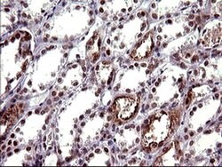 UPRT Monoclonal Antibody (OTI1A3), TrueMAB , OriGene 100 &mu;L; Unconjugated:Antibodies,