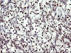 UPRT Monoclonal Antibody (OTI1A3), TrueMAB , OriGene 100 &mu;L; Unconjugated:Antibodies,