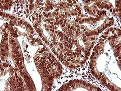 UPRT Monoclonal Antibody (OTI2F2), TrueMAB , OriGene 100 &mu;L; Unconjugated:Antibodies,