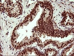 UPRT Monoclonal Antibody (OTI2F2), TrueMAB , OriGene 100 &mu;L; Unconjugated:Antibodies,