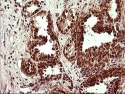 UPRT Monoclonal Antibody (OTI2F2), TrueMAB , OriGene 100 &mu;L; Unconjugated:Antibodies,