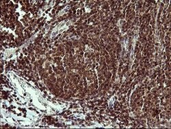 UPRT Monoclonal Antibody (OTI2F2), TrueMAB , OriGene 100 &mu;L; Unconjugated:Antibodies,