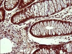 UPRT Monoclonal Antibody (OTI2F2), TrueMAB , OriGene 100 &mu;L; Unconjugated:Antibodies,