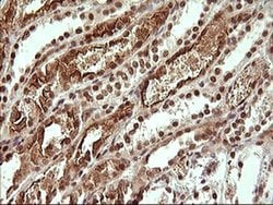 UPRT Monoclonal Antibody (OTI2F2), TrueMAB , OriGene 100 &mu;L; Unconjugated:Antibodies,