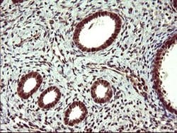 UPRT Monoclonal Antibody (OTI3A3), TrueMAB , OriGene 100 &mu;L; Unconjugated:Antibodies,