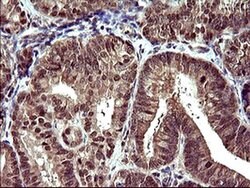 UPRT Monoclonal Antibody (OTI3A3), TrueMAB , OriGene 100 &mu;L; Unconjugated:Antibodies,
