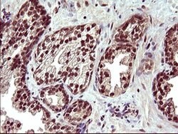 UPRT Monoclonal Antibody (OTI3A3), TrueMAB , OriGene 100 &mu;L; Unconjugated:Antibodies,