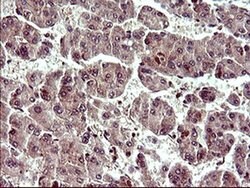 UPRT Monoclonal Antibody (OTI3A3), TrueMAB , OriGene 100 &mu;L; Unconjugated:Antibodies,