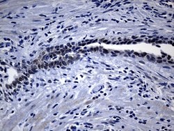 UPRT Monoclonal Antibody (OTI1D11), TrueMAB , OriGene:Antibodies:Primary