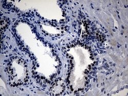 UPRT Monoclonal Antibody (OTI1D11), TrueMAB , OriGene 100 &mu;L; Unconjugated:Antibodies,