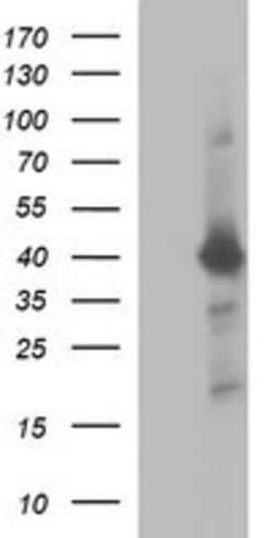 UPRT Mouse anti-Human, Clone: OTI1C9, lyophilized, TrueMAB 100 &mu;g; Unconjugated:Antibodies,
