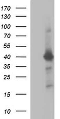 UPRT Monoclonal Antibody (OTI1C9), TrueMAB , OriGene 30 &mu;L; Unconjugated:Antibodies,