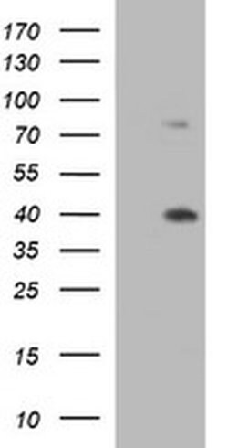 UPRT Monoclonal Antibody (OTI1A3), TrueMAB , OriGene 100 &mu;L; Unconjugated:Antibodies,