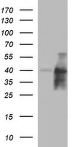 UPRT Monoclonal Antibody (OTI2F2), TrueMAB , OriGene 100 &mu;L; Unconjugated:Antibodies,