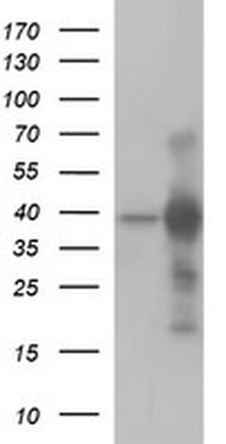 UPRT Monoclonal Antibody (OTI3A3), TrueMAB , OriGene 100 &mu;L; Unconjugated:Antibodies,