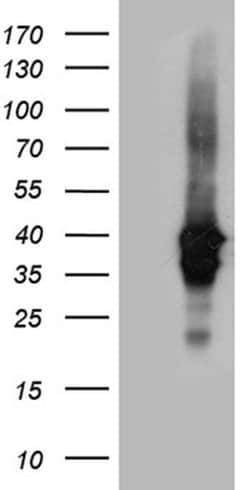 UPRT Monoclonal Antibody (OTI1D11), TrueMAB , OriGene 100 &mu;L; Unconjugated:Antibodies,
